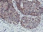 CoA Synthase Antibody in Immunohistochemistry (Paraffin) (IHC (P))