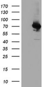 CoA Synthase Antibody in Western Blot (WB)