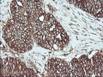 ATG3 Antibody in Immunohistochemistry (Paraffin) (IHC (P))