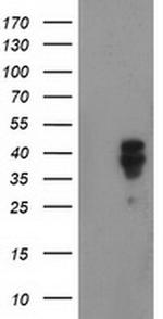 Nudel Antibody in Western Blot (WB)