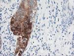 Nudel Antibody in Immunohistochemistry (Paraffin) (IHC (P))