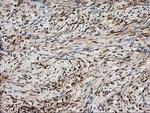 Nudel Antibody in Immunohistochemistry (Paraffin) (IHC (P))