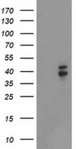 Nudel Antibody in Western Blot (WB)