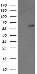 GTF2F1 Antibody in Western Blot (WB)