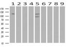 ANAPC2 Antibody in Western Blot (WB)