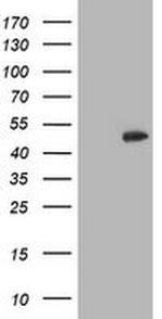 CCM2 Antibody in Western Blot (WB)