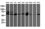 CCM2 Antibody in Western Blot (WB)