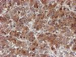 CYP17A1 Antibody in Immunohistochemistry (Paraffin) (IHC (P))