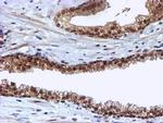 CYP17A1 Antibody in Immunohistochemistry (Paraffin) (IHC (P))