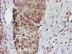 CYP17A1 Antibody in Immunohistochemistry (Paraffin) (IHC (P))