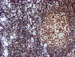 CYP17A1 Antibody in Immunohistochemistry (Paraffin) (IHC (P))