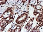 CYP17A1 Antibody in Immunohistochemistry (Paraffin) (IHC (P))