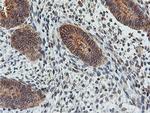 FDFT1 Antibody in Immunohistochemistry (Paraffin) (IHC (P))