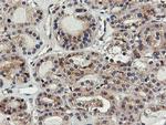 FDFT1 Antibody in Immunohistochemistry (Paraffin) (IHC (P))