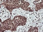 PDE4B Antibody in Immunohistochemistry (Paraffin) (IHC (P))