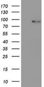 PDE4B Antibody in Western Blot (WB)