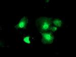 DTYMK Antibody in Immunocytochemistry (ICC/IF)