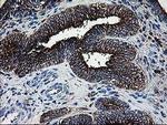 DTYMK Antibody in Immunohistochemistry (Paraffin) (IHC (P))