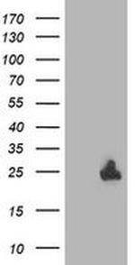 DTYMK Antibody in Western Blot (WB)