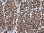 PNPO Antibody in Immunohistochemistry (Paraffin) (IHC (P))