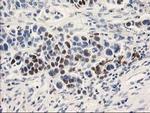 UNG Antibody in Immunohistochemistry (Paraffin) (IHC (P))