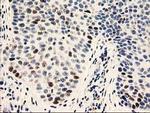 UNG Antibody in Immunohistochemistry (Paraffin) (IHC (P))