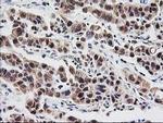 PSMB4 Antibody in Immunohistochemistry (Paraffin) (IHC (P))