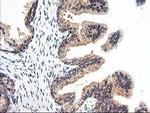 PSMB4 Antibody in Immunohistochemistry (Paraffin) (IHC (P))