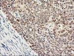 PSMB4 Antibody in Immunohistochemistry (Paraffin) (IHC (P))