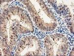 PSMB4 Antibody in Immunohistochemistry (Paraffin) (IHC (P))