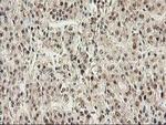 PSMB4 Antibody in Immunohistochemistry (Paraffin) (IHC (P))