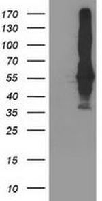 SEC14L2 Antibody in Western Blot (WB)