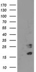 CDKN3 Antibody in Western Blot (WB)