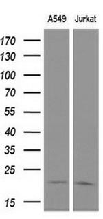 CDKN3 Antibody in Western Blot (WB)