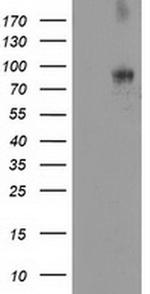 DPP10 Antibody in Western Blot (WB)