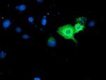 GBP1 Antibody in Immunocytochemistry (ICC/IF)