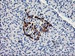 ACSS2 Antibody in Immunohistochemistry (Paraffin) (IHC (P))