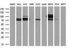 ACSS2 Antibody in Western Blot (WB)