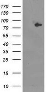 ACSS2 Antibody in Western Blot (WB)