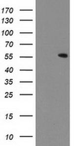 CNDP2 Antibody in Western Blot (WB)