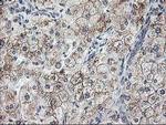 Ribophorin I Antibody in Immunohistochemistry (Paraffin) (IHC (P))