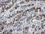 Ribophorin I Antibody in Immunohistochemistry (Paraffin) (IHC (P))