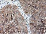 Ribophorin I Antibody in Immunohistochemistry (Paraffin) (IHC (P))