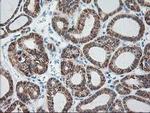 Ribophorin I Antibody in Immunohistochemistry (Paraffin) (IHC (P))