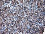 Ribophorin I Antibody in Immunohistochemistry (Paraffin) (IHC (P))