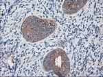 Ribophorin I Antibody in Immunohistochemistry (Paraffin) (IHC (P))