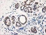 PIG3 Antibody in Immunohistochemistry (Paraffin) (IHC (P))