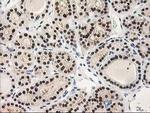 PIG3 Antibody in Immunohistochemistry (Paraffin) (IHC (P))