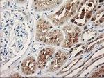 PIG3 Antibody in Immunohistochemistry (Paraffin) (IHC (P))