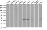 PIG3 Antibody in Western Blot (WB)